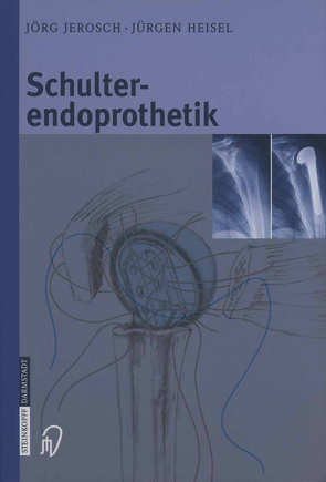 Schulterendoprothetik von Attmanspacher,  W., Heisel,  Jürgen, Jerosch,  Jörg, Mansat,  M., Neer ,  C.S.