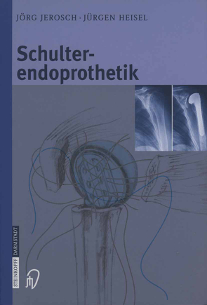 Schulterendoprothetik von Attmanspacher,  W., Heisel,  Jürgen, Jerosch,  Jörg, Mansat,  M., Neer ,  C.S.