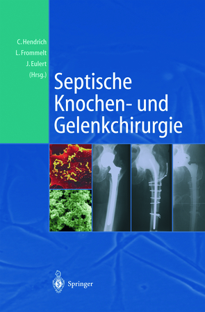 Septische Knochen-und Gelenkchirurgie von Eulert,  Jochen, Frommelt,  Lars, Hendrich,  Christian