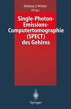 Single-Photon-Emissions-Computertomographie (SPECT) des Gehirns von Wieler,  Helmut J.