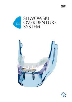 SOS – Sliwowski Overdenture System von Sliwowski,  Christoph T.