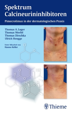 Spektrum Calcineurininhibitoren: Pimecrolimus in der dermatologischen Praxis von Dirschka,  Thomas, Hengge,  Ulrich R., Keller,  Hanno, Luger,  Thomas A.