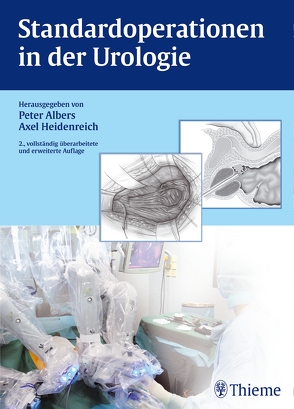 Standardoperationen in der Urologie von Albers,  Peter, Heidenreich,  Axel
