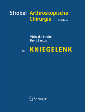 Strobel Arthroskopische Chirurgie von Strobel,  Michael J., Zantop,  Thore
