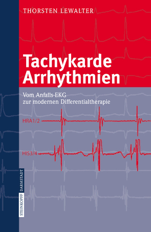 Tachykarde Arrhythmien von Lewalter,  Thorsten