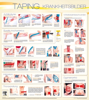 Taping Wandtafel Krankheitsbilder von Ilbeygui,  Ramin