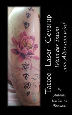 Tattoo – Laser – Cover Up von Tessnow,  Antonia Katharina