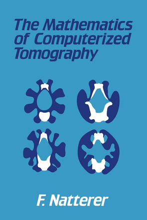 The Mathematics of Computerized Tomography von Natterer,  F.
