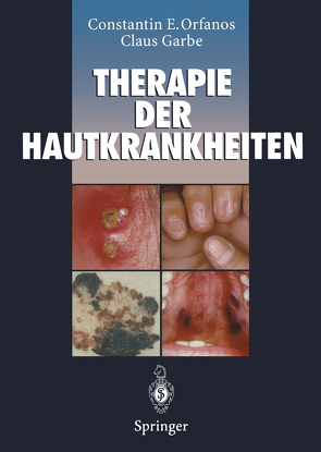 Therapie der Hautkrankheiten von Blume-Peytavi,  U., Garbe,  Claus, Gollnick,  H., Orfanos,  Constantin E., Tebbe,  B., Zouboulis,  C.C.