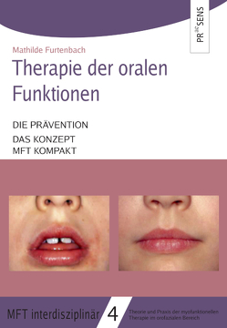 Therapie der oralen Funktionen von Furtenbach,  Mathilde