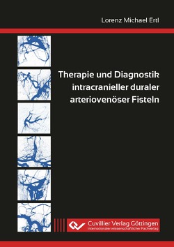 Therapie und Diagnostik intracranieller duraler arteriovenöser Fisteln von Ertl,  Lorenz Michael