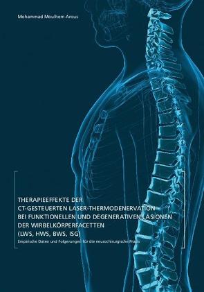 Therapieeffekte der CT-gesteuerten Laser-Thermodenervation bei funktionellen und degenerativen Läsionen der Wirbelsäulenfacetten (LWS, HWS, BWS, ISG) von Arous,  Mohammad Moulhem