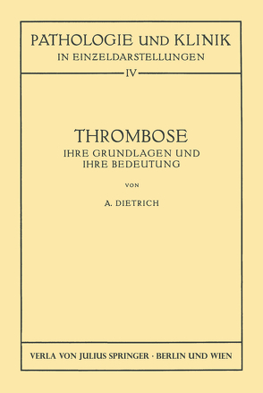 Thrombose von Dietrich,  Albert