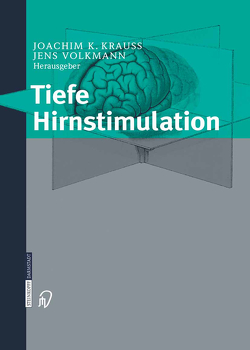 Tiefe Hirnstimulation von Krauss,  J.K., Mundinger,  F., Struppler,  A., Volkmann,  J.