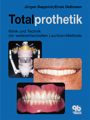 Totalprothetik von Dapprich,  Jürgen, Oidtmann,  Ernst
