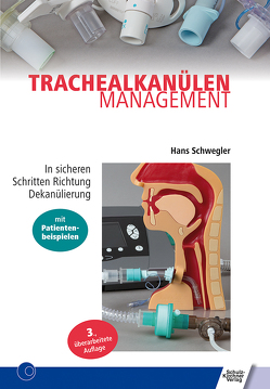 Trachealkanülenmanagement von Schwegler,  Hans