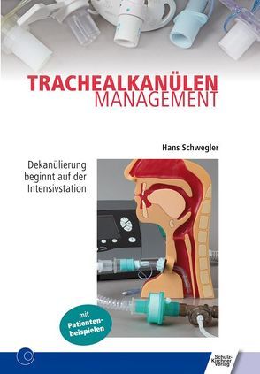 Trachealkanülenmanagement von Schwegler,  Hans
