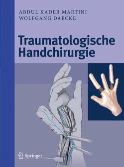 Traumatologische Handchirurgie von Daecke,  Wolfgang, Martini,  Abdul Kader