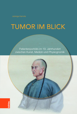 Tumor im Blick von Kamola,  Jadwiga