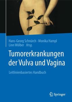 Tumorerkrankungen der Vulva und Vagina von Hampl,  Monika, Schnürch,  Hans-Georg, Wölber,  Linn