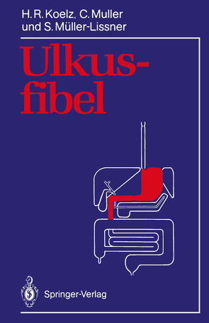 Ulkusfibel von Koelz,  Hans R., Muller,  Claude, Müller-Lissner,  Stefan