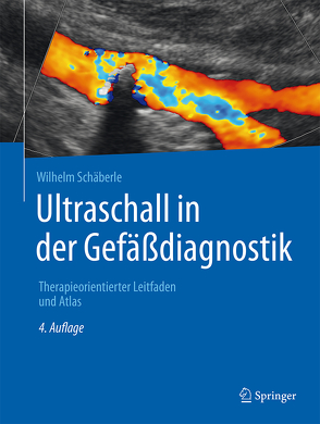 Ultraschall in der Gefäßdiagnostik von Schäberle,  Wilhelm