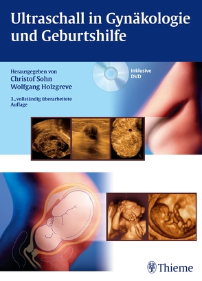 Ultraschall in Gynäkologie und Geburtshilfe von Holzgreve,  Wolfgang, Sohn,  Christof