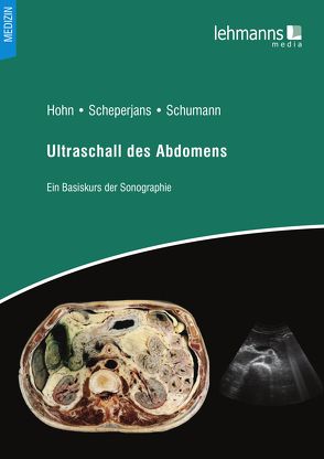 Ultraschallanatomie des Abdomens von Hohn,  Hans-Peter, Scheperjans,  Uwe, Schumann,  Sven
