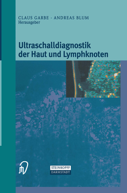 Ultraschalldiagnostik der Haut und Lymphknoten von Blum,  Andreas, Garbe,  Klaus