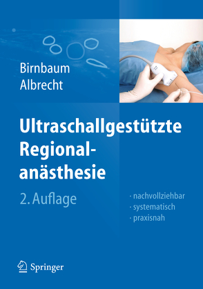 Ultraschallgestützte Regionalanästhesie von Albrecht,  Roland, Birnbaum,  Jürgen