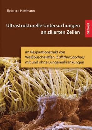 Ultrastrukturelle Untersuchungen an zilierten Zellen von Hoffmann,  Rebecca