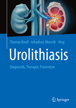 Urolithiasis von Alken,  Peter, Knoll,  Thomas, Miernik,  Arkadiusz