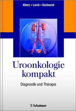 Uroonkologie kompakt von Albers,  Peter