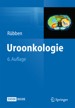 Uroonkologie von Rübben,  Herbert
