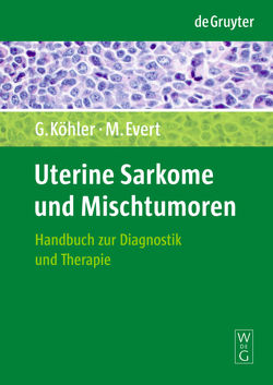 Uterine Sarkome und Mischtumoren von Evert,  Matthias, Köhler,  Günter