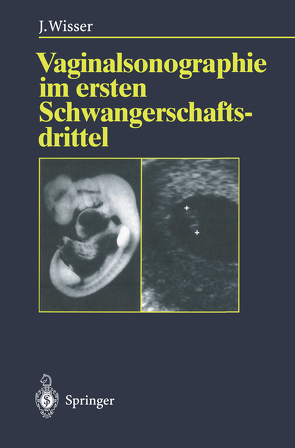 Vaginalsonographie im ersten Schwangerschaftsdrittel von Wisser,  Josef