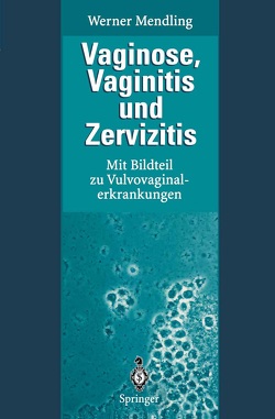 Vaginose, Vaginitis und Zervizitis von Hirsch,  H A, Mendling,  Werner