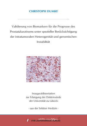 Validierung von Biomarkern für die Prognose des Prostatakarzinoms unter spezieller Berücksichtigung der intratumoralen Heterogenität und genomischen Instabilität von Dumke,  Christoph