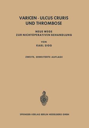 Varicen – Ulcus Cruris und Thrombose von Sigg,  Karl