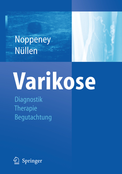 Varikose von Noppeney,  Thomas, Nüllen,  Helmut