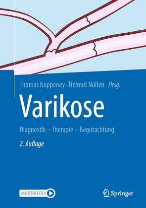 Varikose von Noppeney,  Thomas, Nüllen,  Helmut