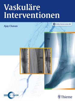 Vaskuläre Interventionen von Chavan,  Ajay