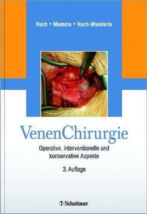 Venen Chirurgie von Hach,  Wolfgang, Hach-Wunderle,  Viola, Mumme,  Achim