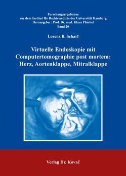 Virtuelle Endoskopie mit Computertomographie post mortem: Herz, Aortenklappe, Mitralklappe von Scharf,  Lorenz B.