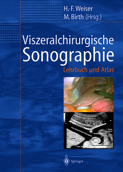 Viszeralchirurgische Sonographie von Birth,  M., Weiser,  H.F.