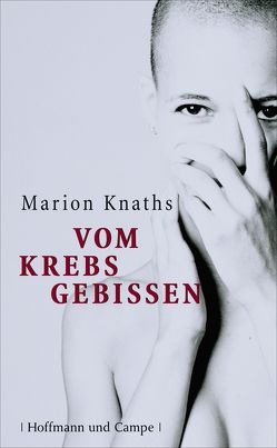 Vom Krebs gebissen von Knaths,  Marion