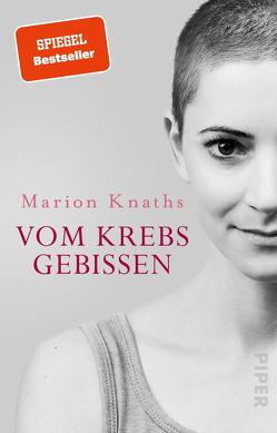 Vom Krebs gebissen von Knaths,  Marion