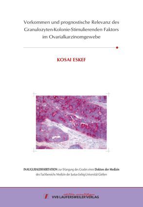 Vorkommen und prognostische Relevanz des Granulozyten-Kolonie-Stimulierenden Faktors im Ovarialkarzinomgewebe von Eskef,  Kosai