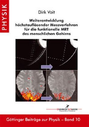 Weiterentwicklung höchstauflösender Messverfahren für die funktionelle MRT des menschlichen Gehirns von Voit,  Dirk