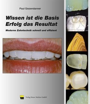 Wissen ist die Basis – Erfolg das Resultat von Giezendanner,  Paul